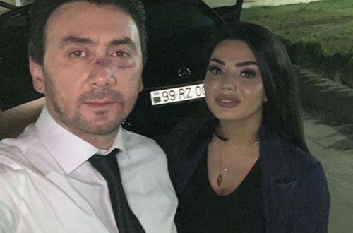 İranlılar Aqşinin 2 milyonluq klipini sildirdi - FOTO