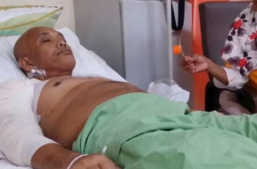 Gündə 2 butulka qazlı su içən kişi şikəst oldu - Qanqrena yayılıb