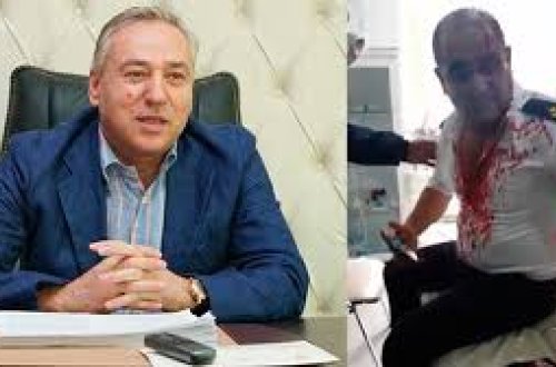 Deputat SOCAR-ın əməkdaşlarına hücum barədə: 