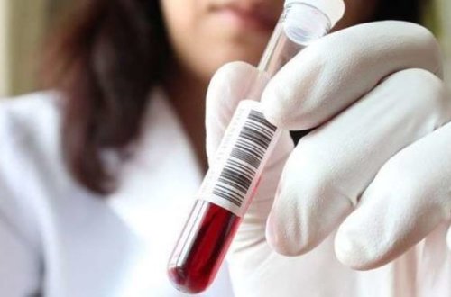 Обнародовано число заболевших сифилисом