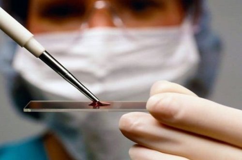 Врачи перепутали аллергию на орехи с опасным синдромом