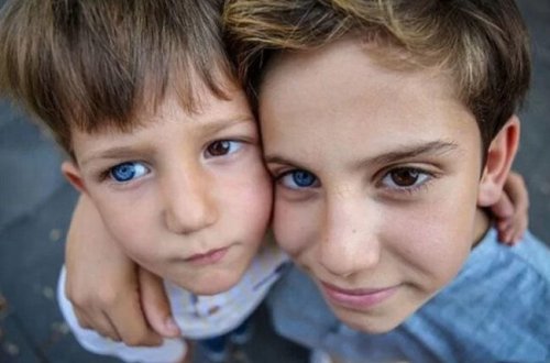 Dünyanı iki fərqli göz rəngi ilə görən qardaşlar