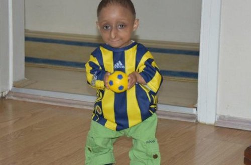 14 yaşı var, cəmi 4 kilodur - 