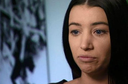 Dodaqlarını böyütmək istəyən qadın kor qalacaqdı - FOTO