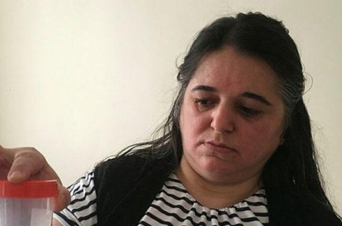 Qadının mədəsindən çıxan həkimləri şoka saldı
