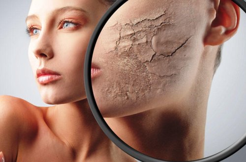 Dərisi quruyanlar, bu vasitəni atın - Nə istifadə etməli?