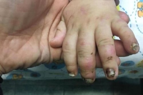 19 yaşlı qız oğlunu vəhşicəsinə döyüb sevgilisilə görüşə getdi