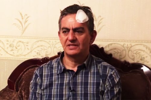 “Əli Kərimli polisləri yaralayıb, başını avtobusa özü vurub” - Baş prokurorluq
