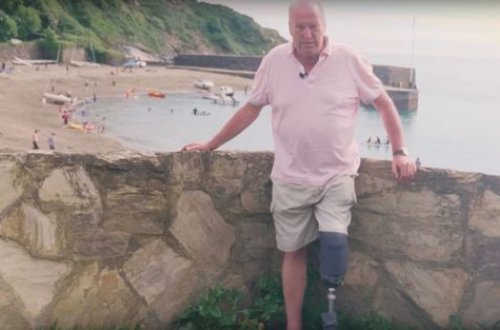 Пенсионер натер ногу сандалиями, не подозревая, что ее придется ампутировать - ФОТО