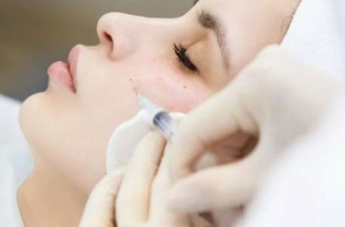 Gözəl burun istəyən qız gözündən oldu