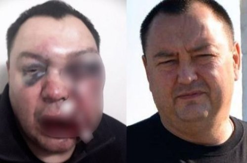 Российского депутата избили железной трубой