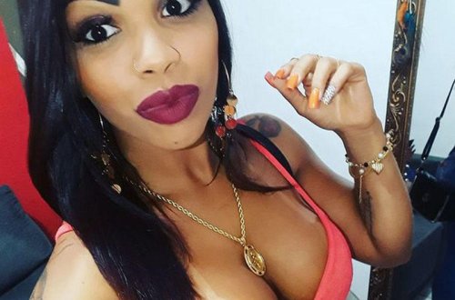 Omba böyütmə əməliyyatı keçirən 3 uşaq anasının budlarında dəliklər əmələ gəldi - FOTO