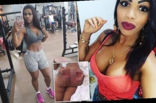 Ombalarını böyütmək istədi - QORXUNC hala qaldı - FOTO-VİDEO