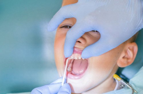 Стоматолог жестко 