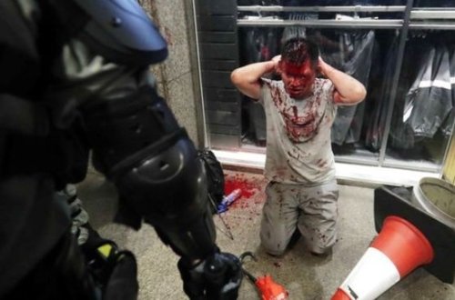 В Гонконге мужчина пожертвовал ухом ради политики - ВИДЕО