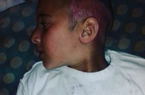 Azərbaycanda atalığından şiddət görən 11 yaşlı uşaq qəbiristanlıqda gizlənib - FOTO