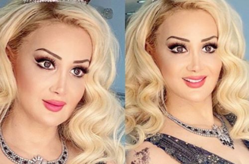 Xalq artisti hönkürtüsünü gülüşündə GİZLƏTDİ