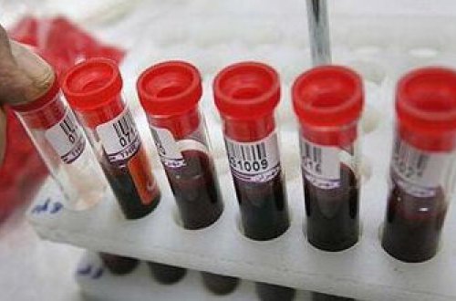 Ötən ay 39 nəfərdə sifilis, 19 şəxsdə isə QİÇS AŞKARLANDI