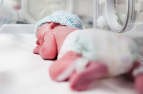 Bakıda ağzı olmayan uşaq dünyaya gəldi - VİDEO