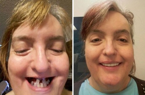 O, insanlara gözəl təbəssümü qaytarır - özü də PULSUZ - FOTO