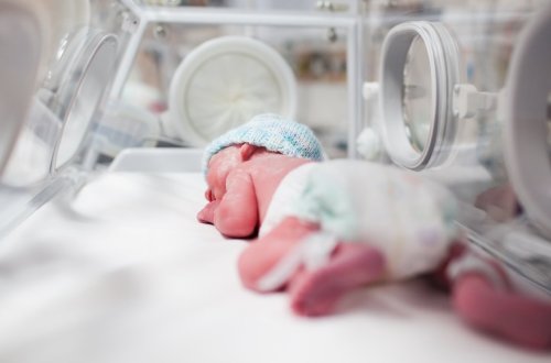 Bakıda doğulan qorxunc körpə ilə bağlı baş ginekoloqdan açıqlama: “Həkim cinayət edib”