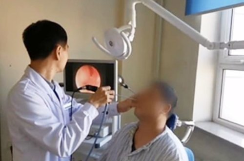 Мужчина десятки лет жил с зубом в носу - ВИДЕО