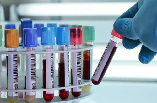 Azərbaycanın qonşuluğunda QİÇS TƏHLÜKƏSİ: 8 min nəfər bu xəstəliyə yoluxub