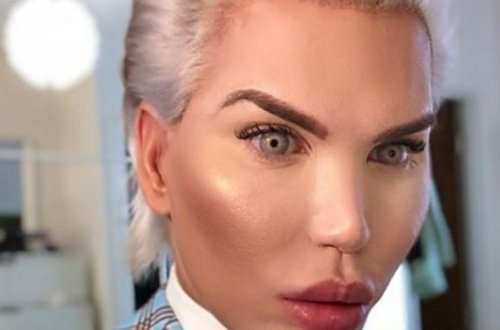 «Живой Кен» избавился от ненастоящего пресса ради следующей безумной операции