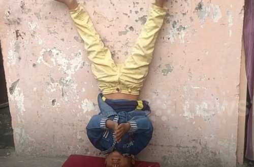 У мальчика из Индии нашли хвост - ВИДЕО