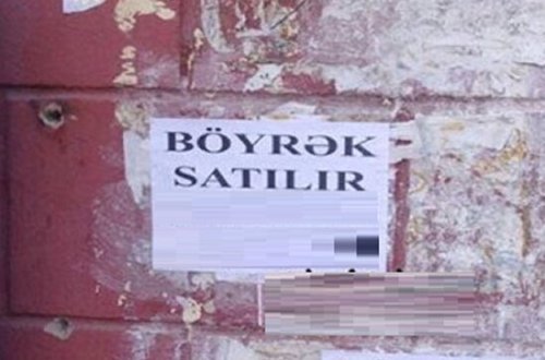 Bakıda böyrəyini satışa çıxaran qadınla bağlı ŞOK XƏBƏR