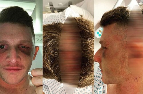 Dəhşətli hadisə: Məşhur oyunçu matçda kor oldu - FOTOLAR