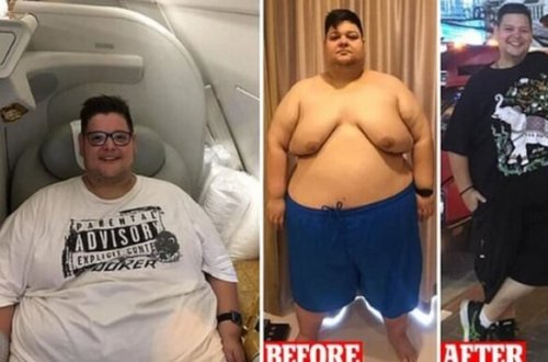 Bu adam istirahət edərək və ac qalmadan 200 kq ARIQLADI - FOTOLAR