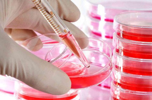 İranda 60 min nəfər QİÇS-ə yoluxub