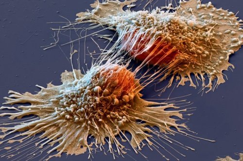 Ученые разобрались, что происходит в клеточных ядрах при развитии рака