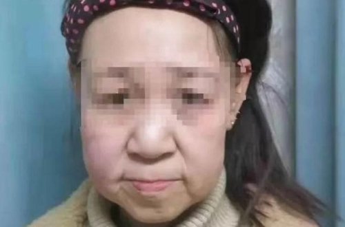 15 yaşlı qız qoca qarı kimi görünür - Təhqir olundu, məktəbi atdı - FOTO