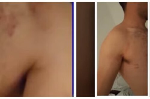 Azərbaycanda BİABIRÇILIQ - Gənci soyundurub kafenin qarşısına atdılar - FOTOLAR