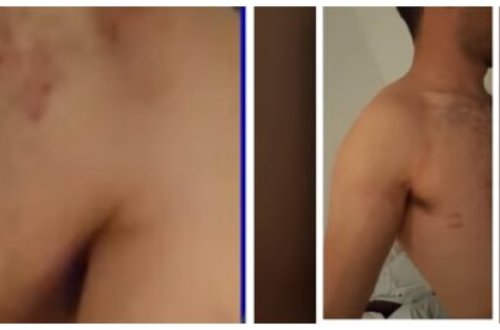 Azərbaycanda BİABIRÇILIQ - Gənci soyundurub kafenin qarşısına atdılar - FOTOLAR