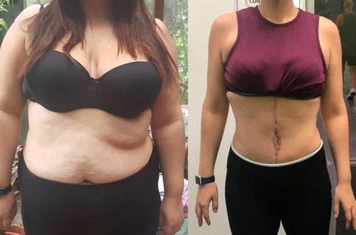 Erotik fantaziyasına görə 63 kq arıqlayan qadın görənləri təəccübləndirir - FOTO