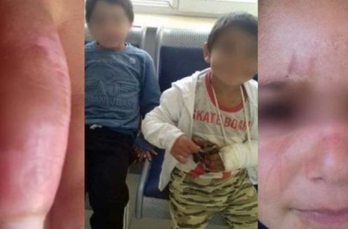 Госкомитет начал разбирательство по факту избиения в Баку детей мачехой