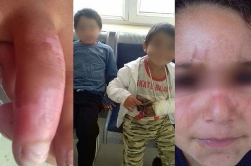 Bakıda uşaqların ögey anaları tərəfindən döyülməsi faktı ilə bağlı araşdırmalara başlanıldı