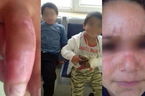 Atası ilə ögey anası tərəfindən döyülən qardaşlarla bağlı rəsmi AÇIQLAMA