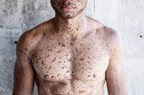 Çilləri ilə məhşur olan model - FOTOLAR