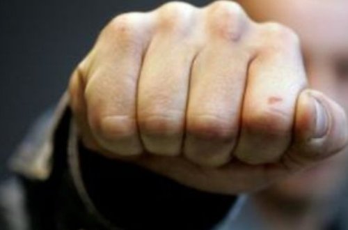 В Баку молодому парню в драке сломали челюсть