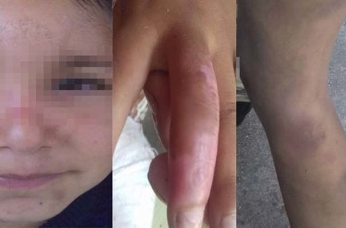 По факту избиения детей отцом и мачехой возбуждено уголовное дело