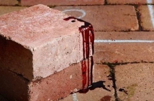 В Баку молодому человеку разбили голову камнем