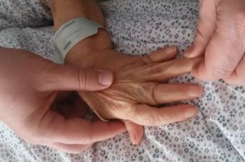 Врачи нашли женщину с раздвигающимися как подзорная труба пальцами