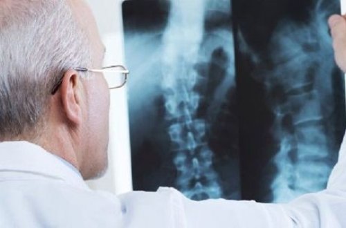 Daşkəsəndə 64 yaşlı qadın yıxılaraq boynunu qırdı