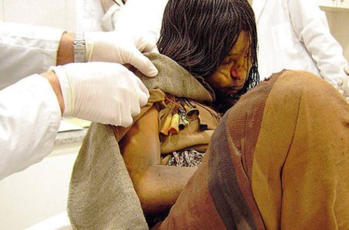 Mumiya tibb işçilərini mat qoydu - 