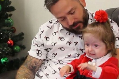 İki yaşlı qız mutasiya nəticəsində qoca qarıya çevrildi