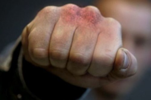 Bakıda keçmiş məhkumlar fahişəliklə məşğul olan homoseksualları döyüblər